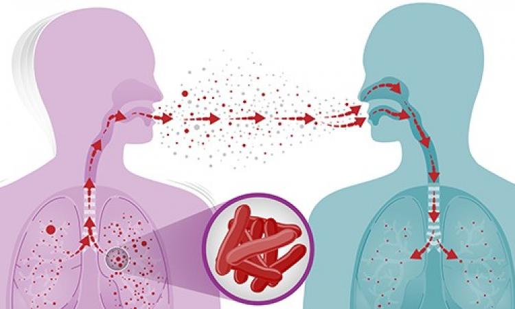 How TB spreads. / Illustration: CDC.